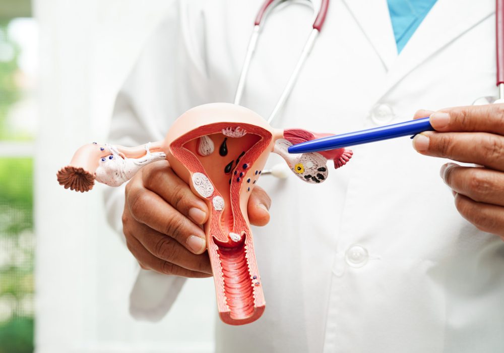 Uterus, doctor holding anatomy model for study diagnosis and treatment in hospital.