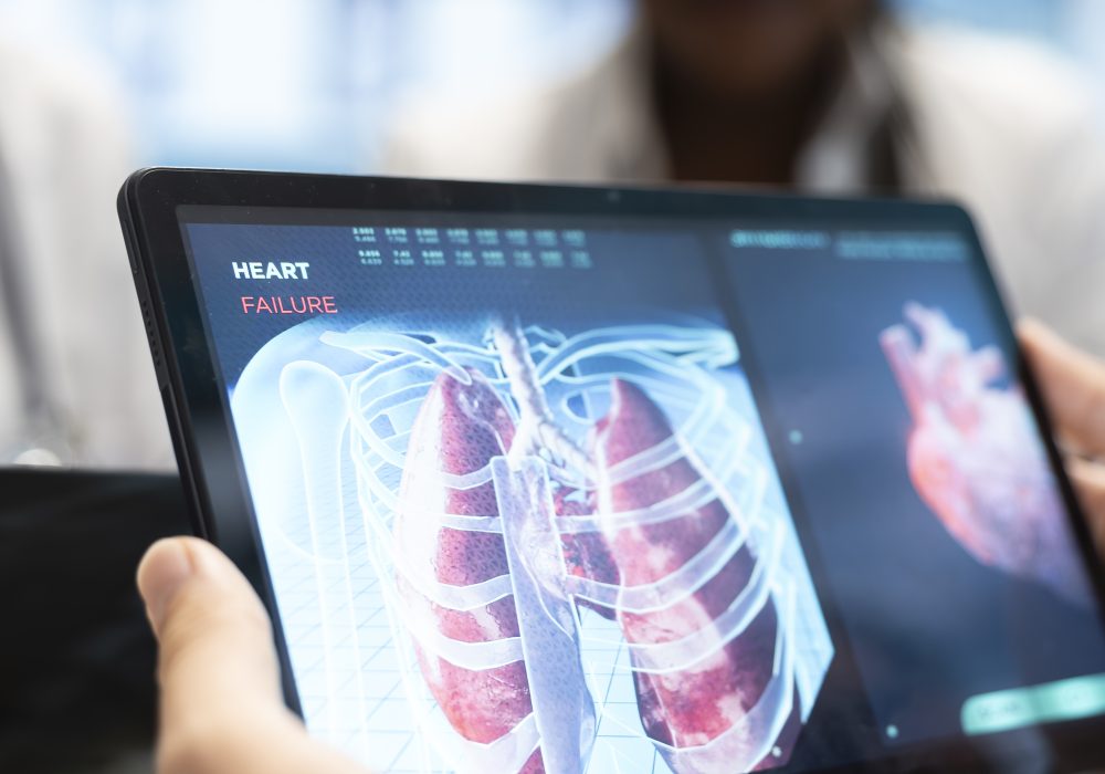Medics and his staff meet to discuss lungs radiography for patient care strategy in a treatment center. Medical team analyze organs x rays and healthcare records to focus on diagnostics. Close up.